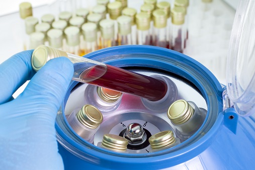 Fproductos sanitarios IVD productos sanitarios IVD